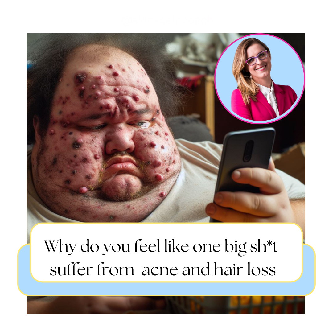 Why Do You Feel Like One Big Sh*t? Suffering from Hair Loss and Acne?