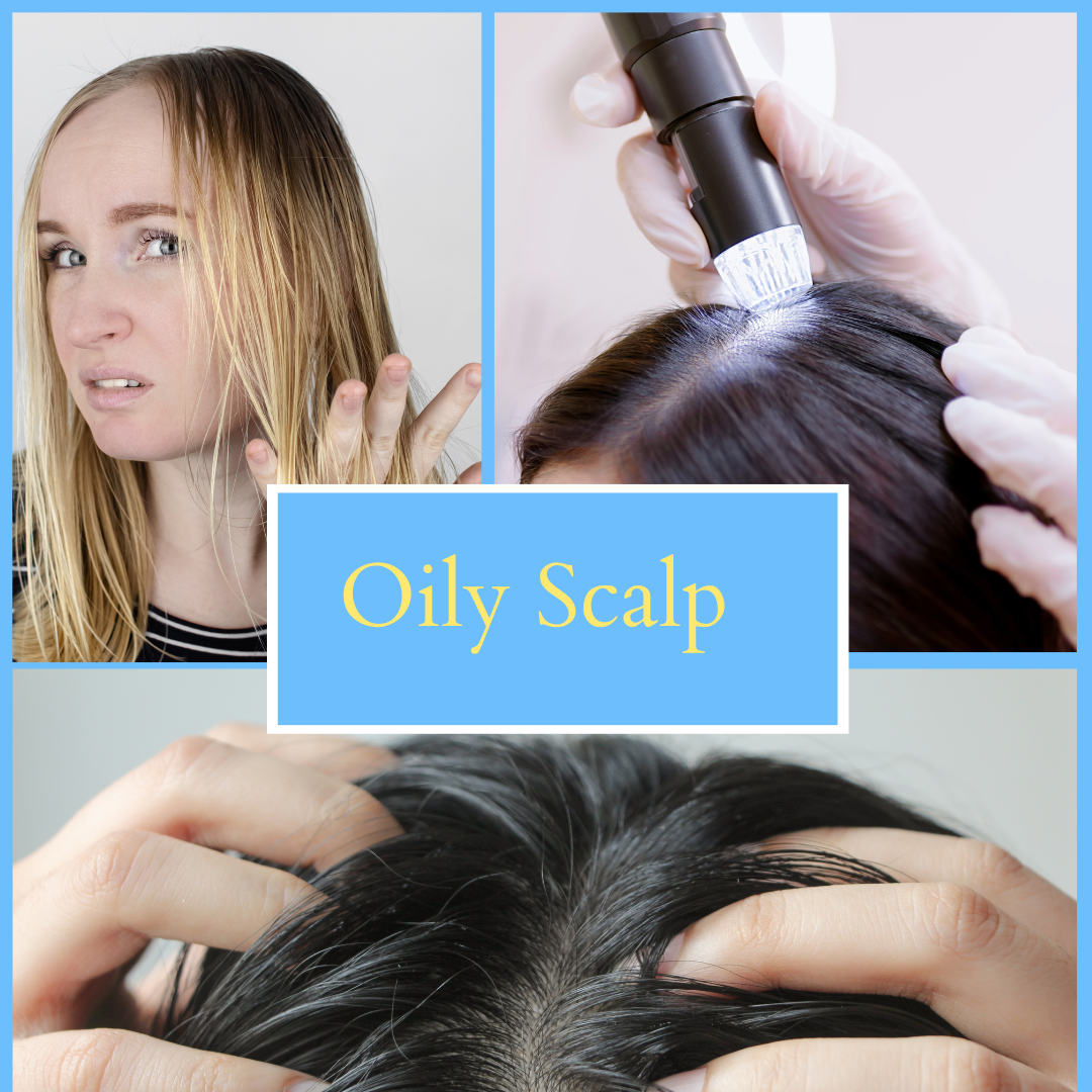 Sebum Control Solutions: Navigating Oily Scalp Challenges with Expert Tips