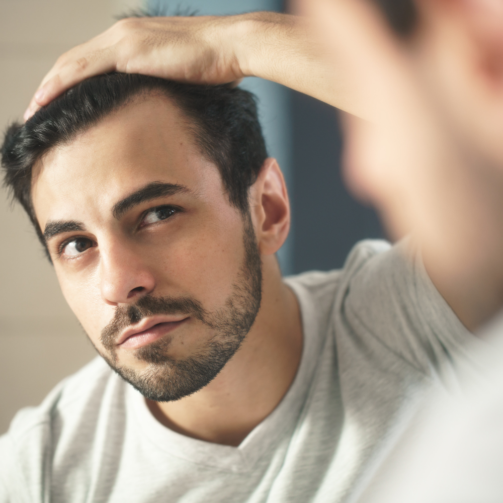 Androgenetic Alopecia (AGA): Causes, Diagnosis, and Treatment Options