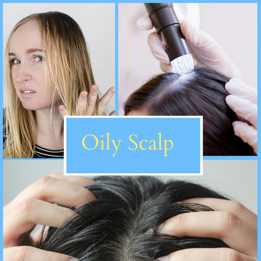 Sebum Control Solutions: Navigating Oily Scalp Challenges with Expert Tips