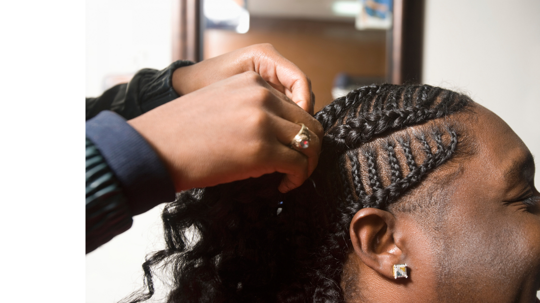 Traction Alopecia: Causes, Prevention & Treatment | Expert Trichology