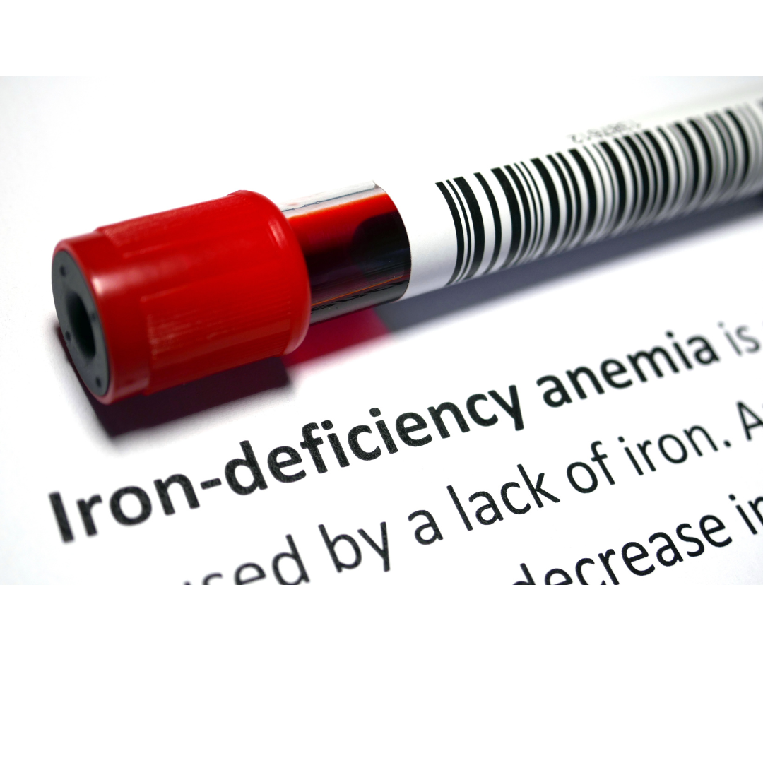 Hair loss and Iron deficiency - guide for beginners.