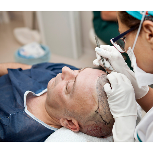 Post-Hair Transplant Care