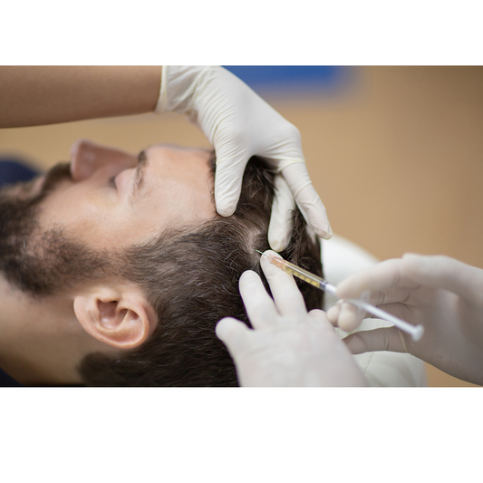 Anti Hair Loss Mesotherapy
